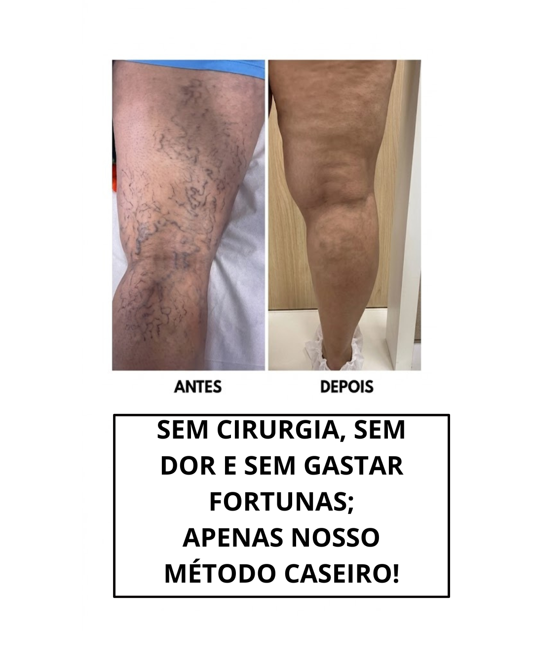NOSSO MÉTODO CASEIRO! (1)